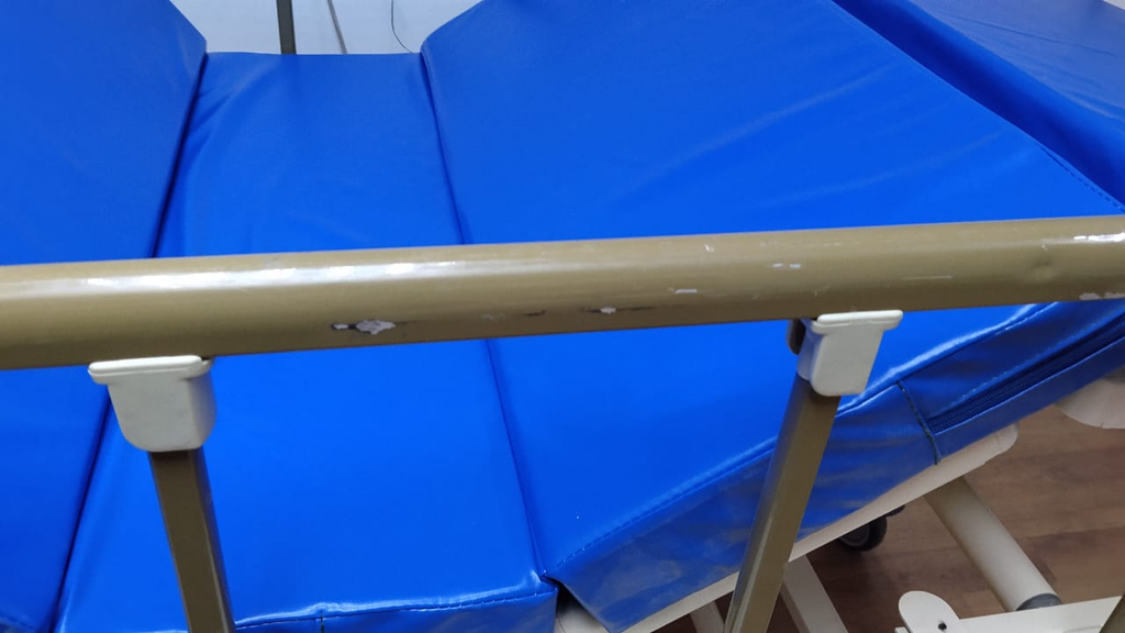 Detalle real de rayaduras y pérdida de pintura en la baranda.